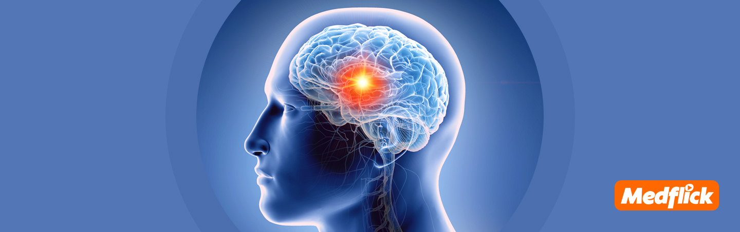 best-brain-tumor-treatment-in-india-cost-and-doctors